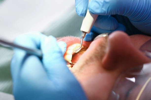 Best Mobile Emergency Dentist in East Liverpool, OH